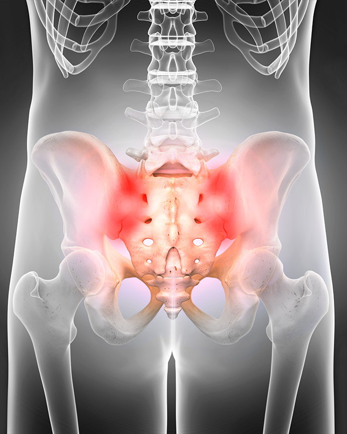 Sacroiliac Joint Injection