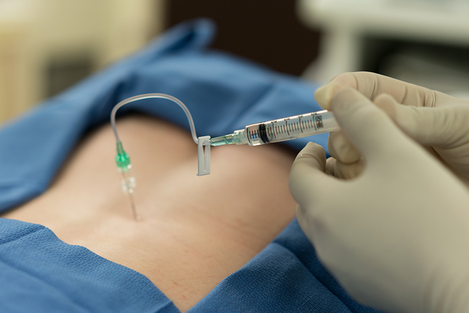 Epidural injection procedure