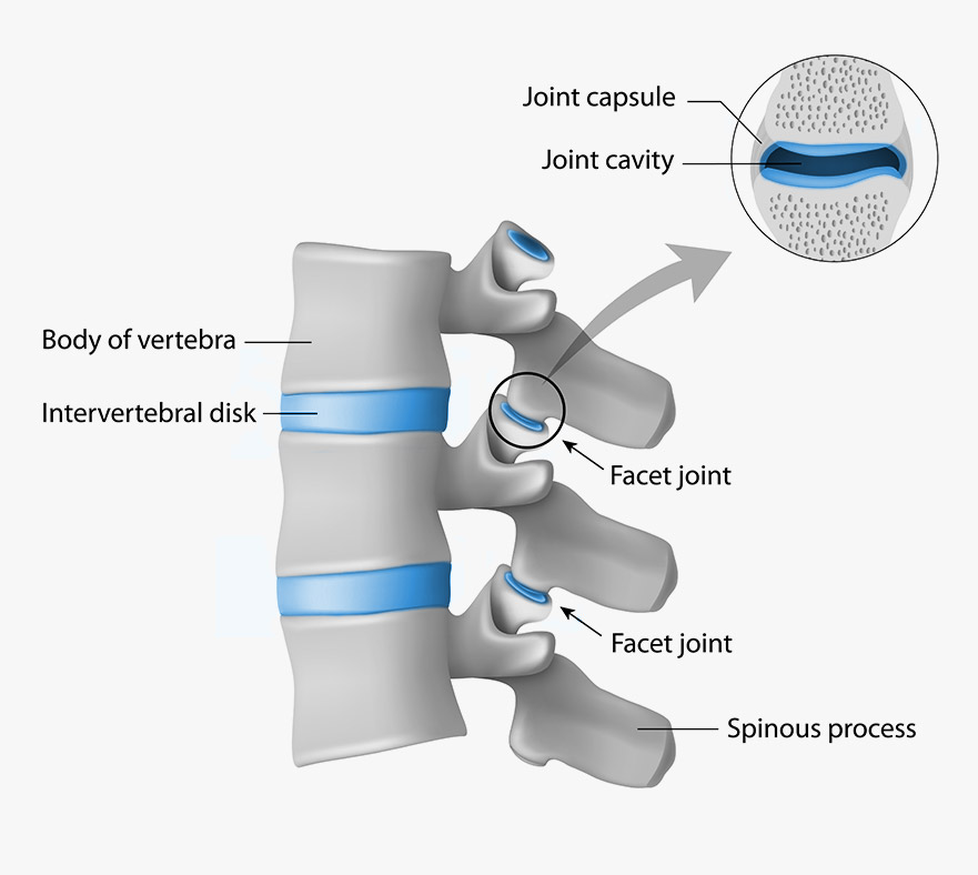 Facet Joint Injection